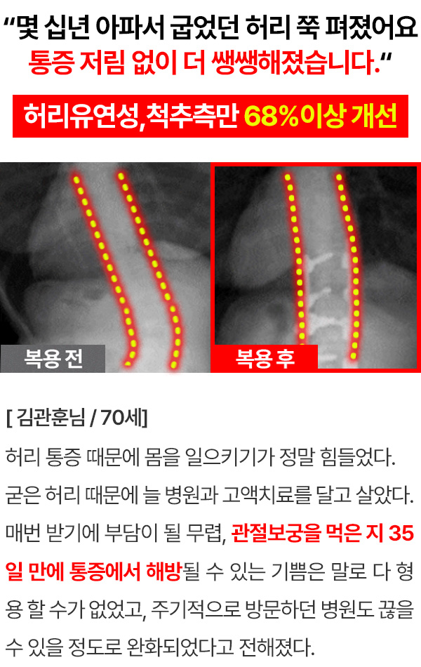 관절보궁